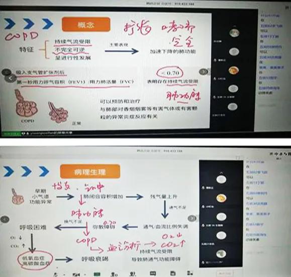 医学届的灵魂画手!安徽一医生“手绘”笔记助力线上教学